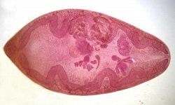 Paragonimus westermani